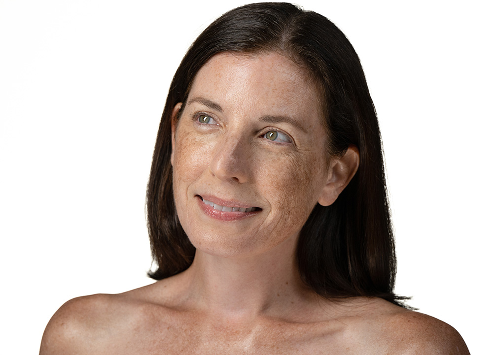 FINE LINES AND WRINKLES