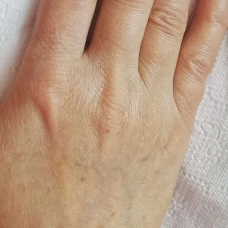result-2-after