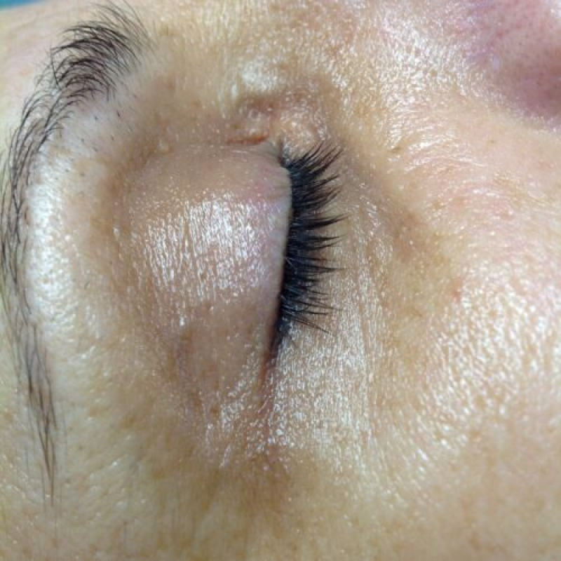 result-5-after