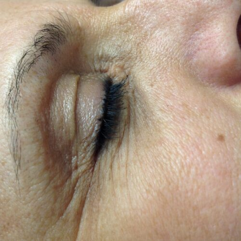 result-5-before