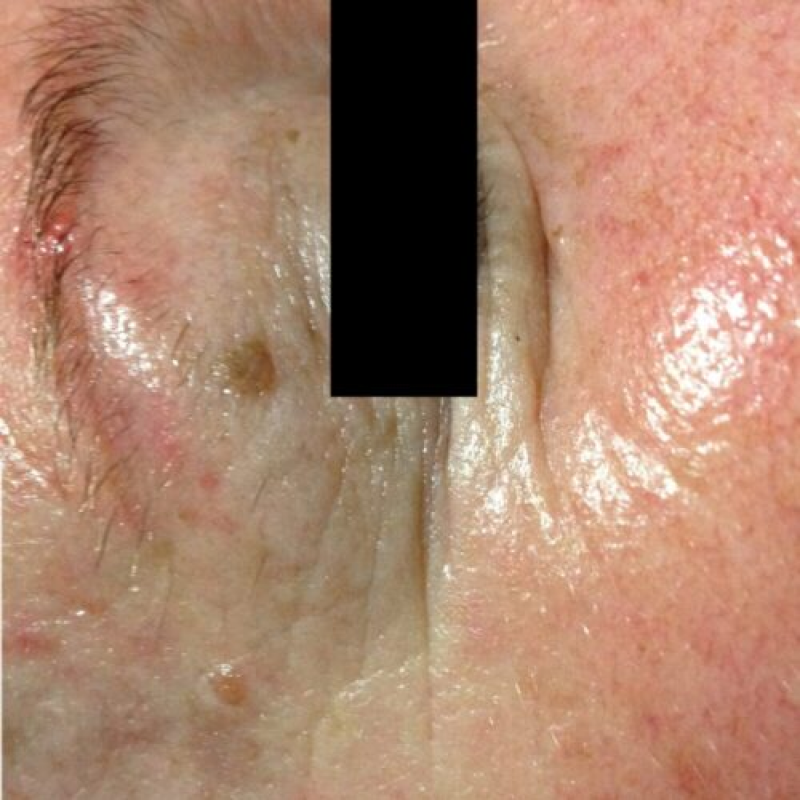 result-6-after