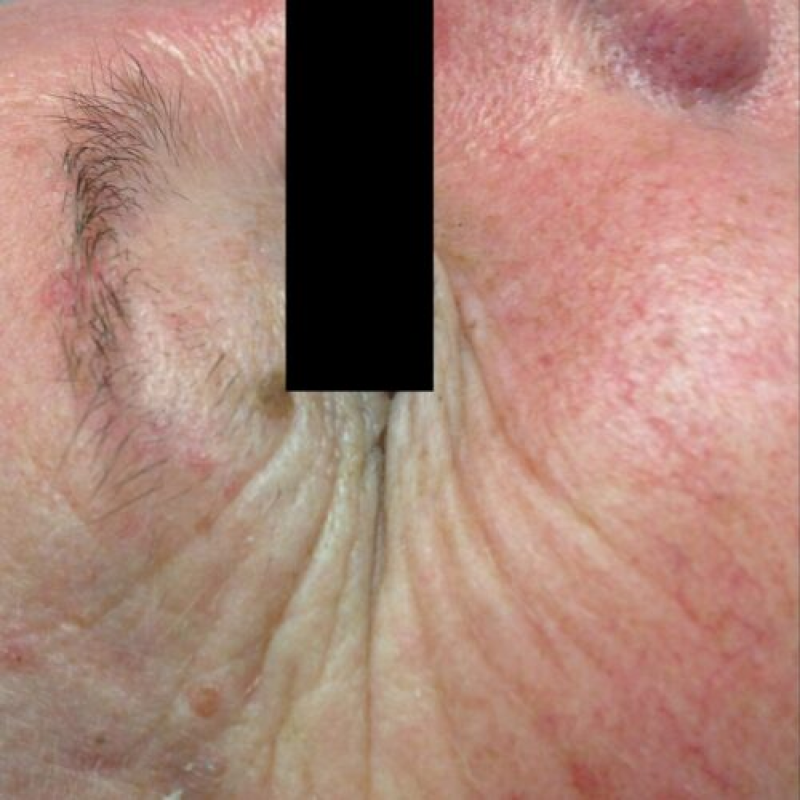 result-6-before