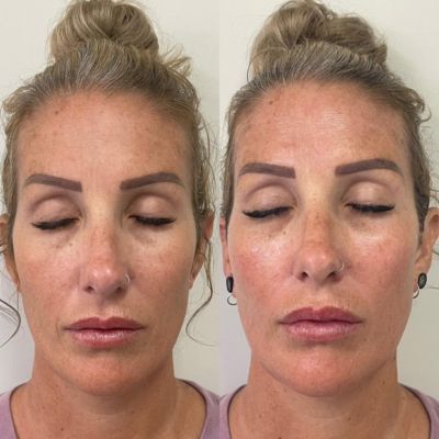 Glo2Facial Australia