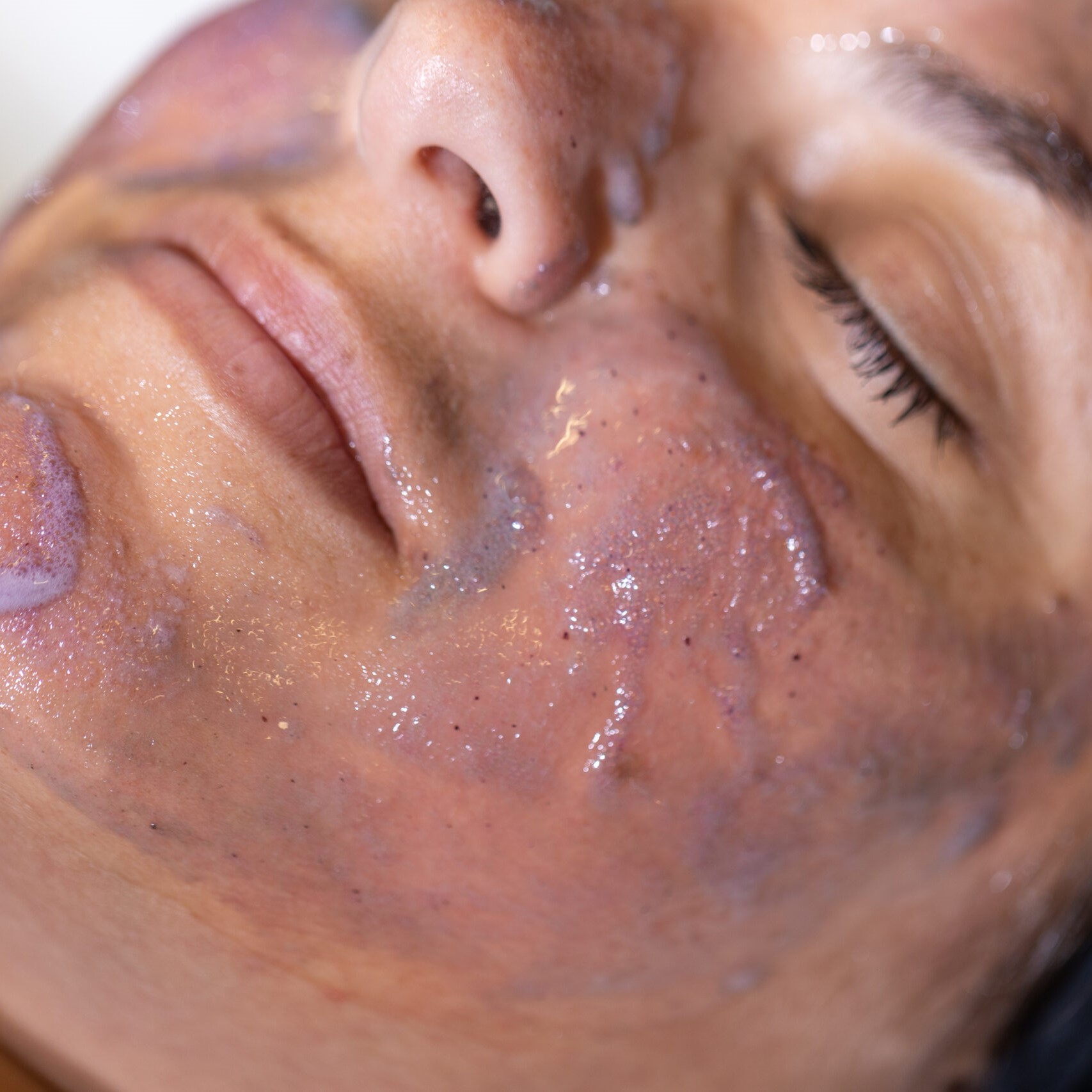 Retouch Treatment