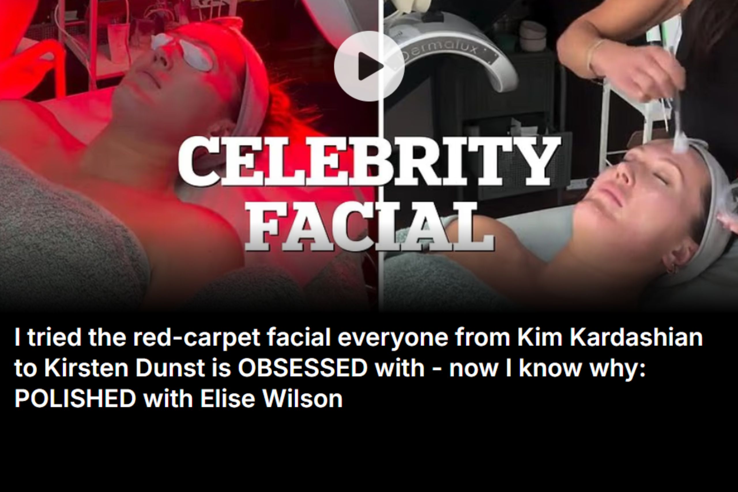 Daily Mail Dubs Pro2Lift ‘Every Celebrity’s Red-Carpet Gospel’